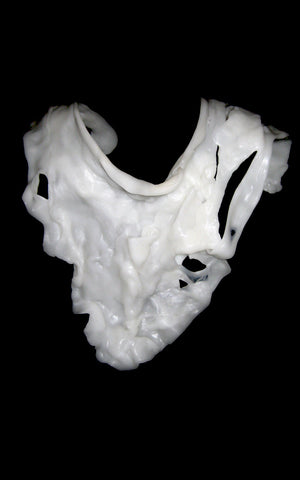 Deformed collar bone. L'une Collection by Anh Volcek